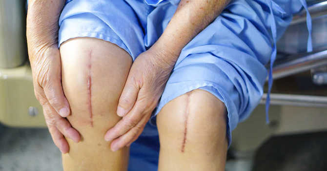 Postoperative pain and Acupuncture image