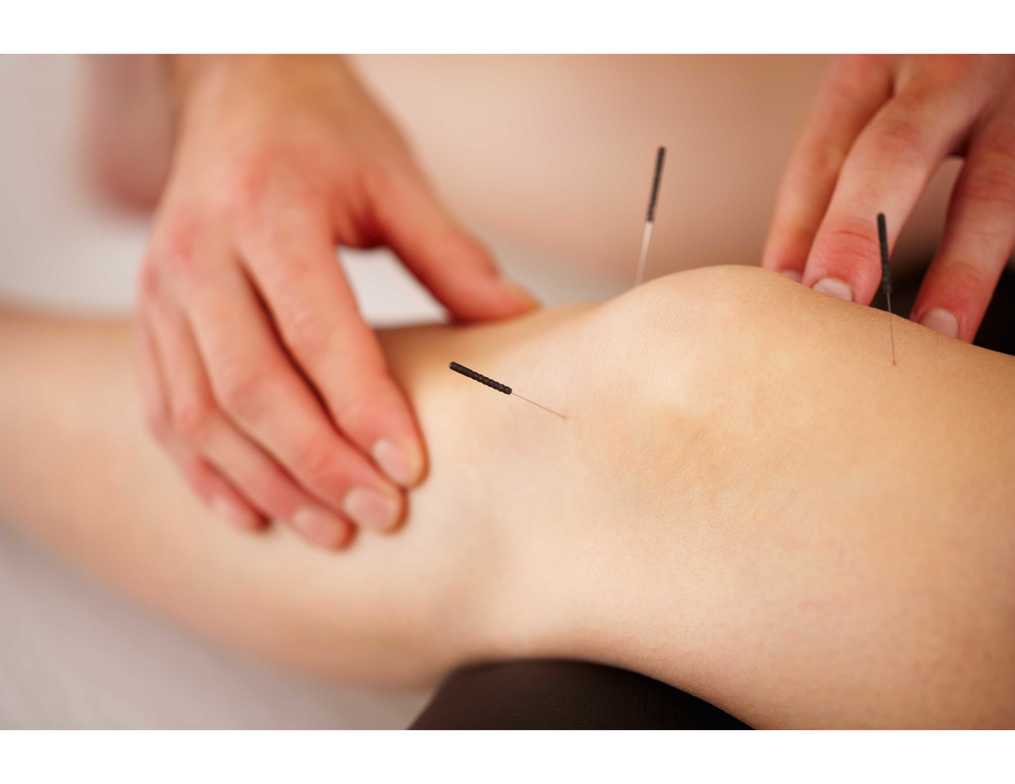 How acupuncture works in Berlin, MD