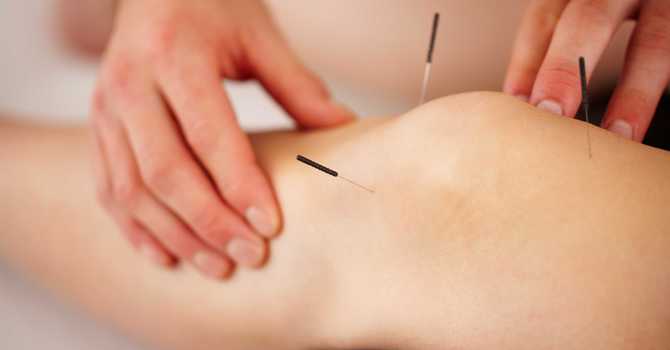 How Acupuncture Works image