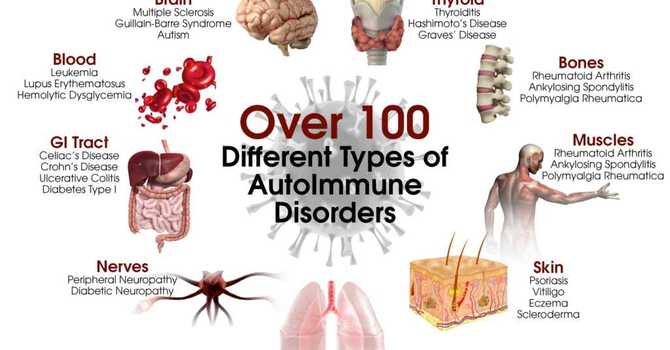 Autoimmune Disorders and Acupuncture image